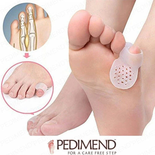 Pedimend™ Pinky Toe Spacers Bunionette Pad for Overlapping & Curled Little Toes