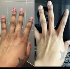 New Strong Whitening Cream For Removing Dark Knuckle Finger Elbow and Knee