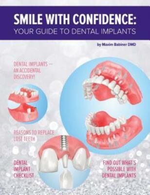 Smile With Confidence: Your Guide To Dental Implants