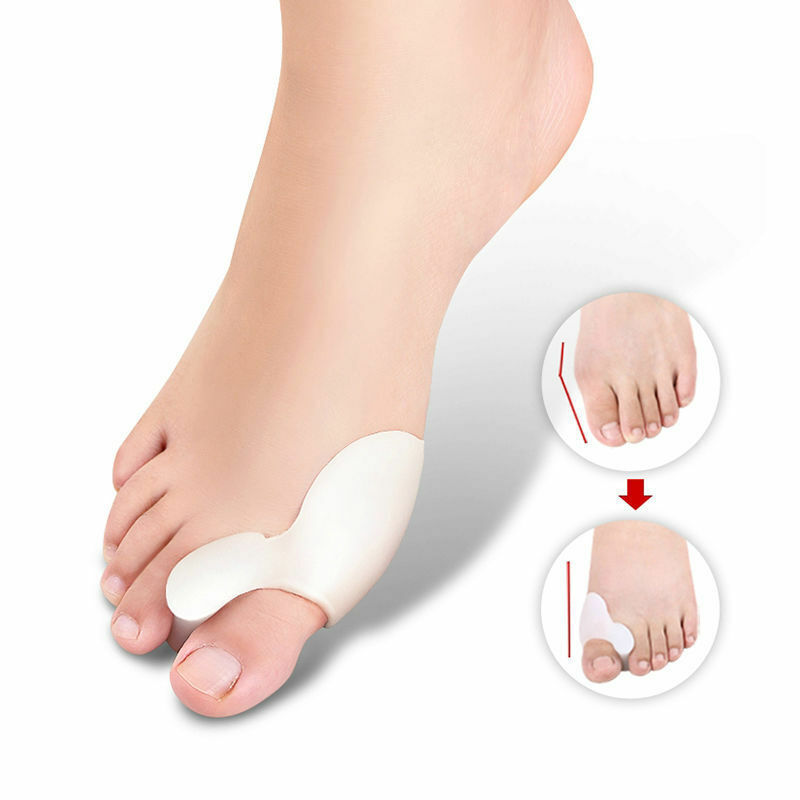 TUTORE ALLUCE VALGO Correttore separatore in Silicone Coppia Protezione cipolla