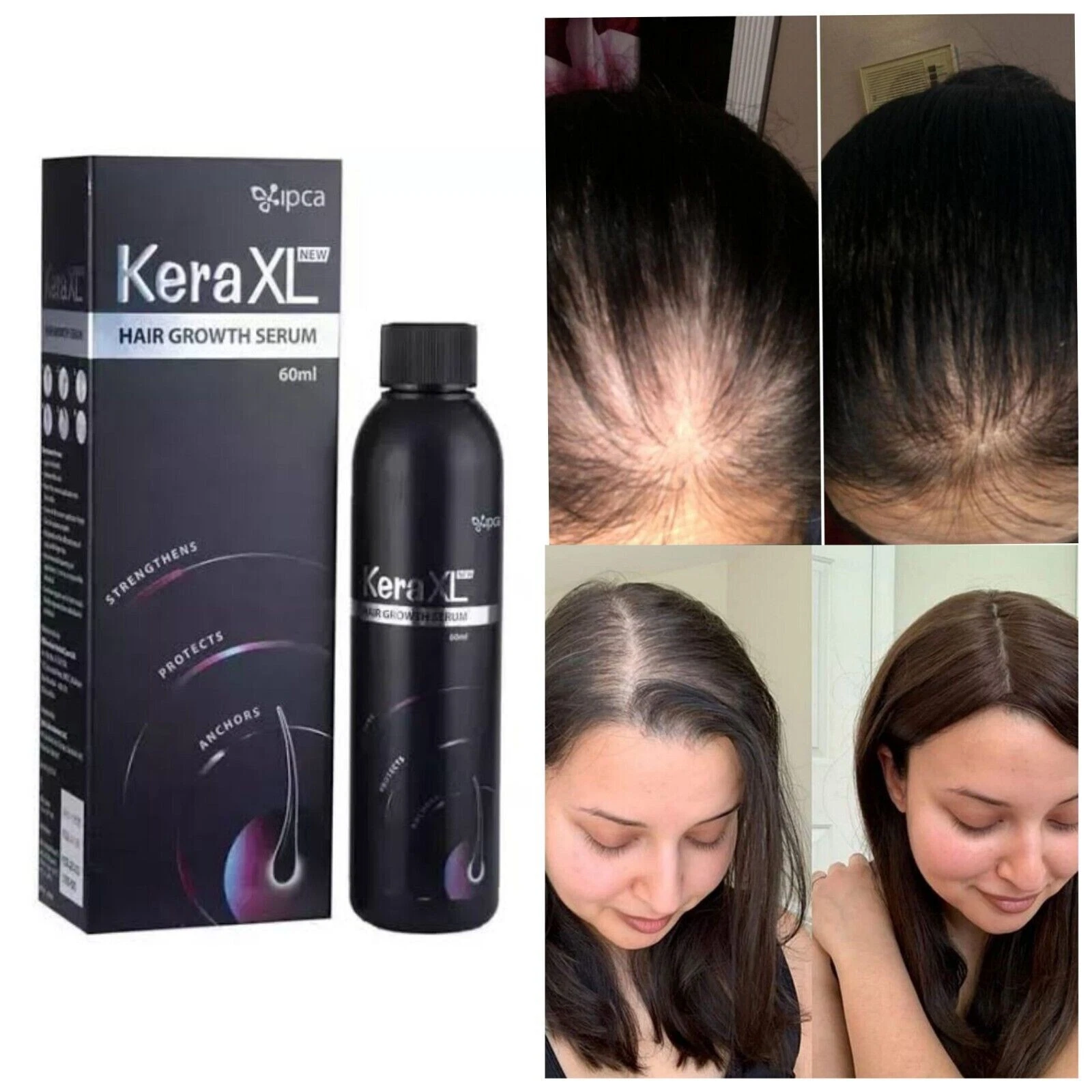Ipca Kera XL New Hair Growth Serum 60 ml 1 Bottle Free Shipping worldwide
Opens in a new window or t