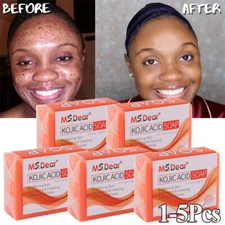 Kojic Acid Soap Dark Skin Whitening Bleaching Lightening Brightening Face & Body