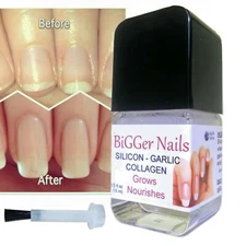 Nail Growth Promoter Thickener Garlic Silica Castor Oil Collagen Gel By ALKAVITA