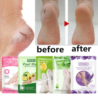 Peeling Fußmaske Peel Off Fußsocke weich Babyfüße entfernt abgestorbene Haut Hornhaut