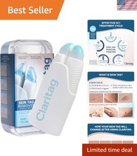 Advanced Skin Tag Remover - -Cleared Device - Only for Skin Tag Removal - Wor...