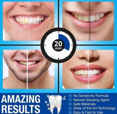28 Behandlung 30 Zahnpasta Tabs Zahnaufhellungsset & Light Tray Bleaching ANGEBOT