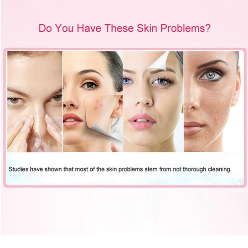 Diamond Blackhead Vacuum Suction Removal Face Cleaner Skin Care Beauty Device - Picture 17 of 24