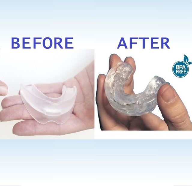 Dental Mouth Guard CUSTOMFIT Anti Snore Night Sleep Apnea Mouthpiece
