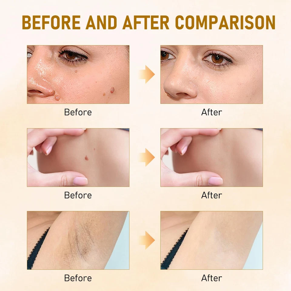 Crema todo en uno para tratamiento de la piel 2025 profesional veneno de abeja 2 piezas Foto 4 de 4