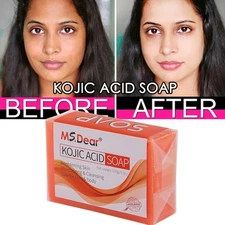 Kojic Acid Soap Dark Spot Remover Skin Lightening Face Whitening Body Bleaching