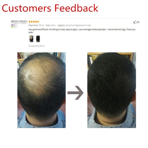 Hair Loss Care Powder 25/50//100g Refill Concealer Sevich Hair Building Fibers - Picture 4 of 22