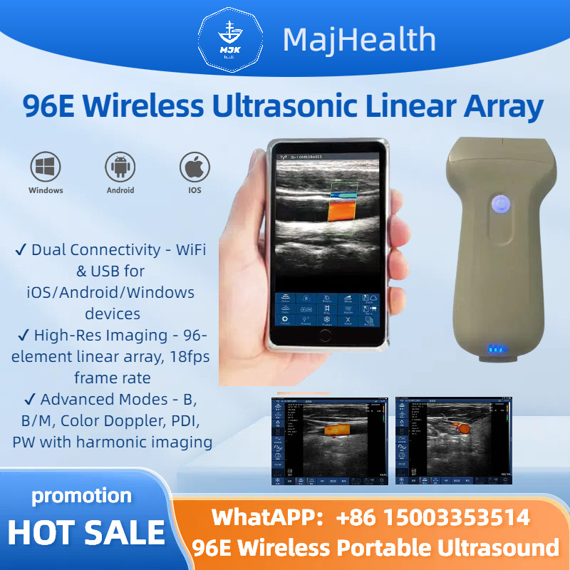 Portable 96E Ultrasound Machine Wireless w/ Color Doppler & Linear Probe