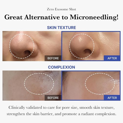 Zero Exosome Shot 7,500 PPM Spicule Facial Serum | Liquid Skin Booster Serum | E - Picture 2 of 7