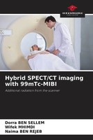 Dorra Ben Sellem (U. A.) | Hybrid Spect/Ct Imaging With 99Mtc-Mibi | Taschenbuch