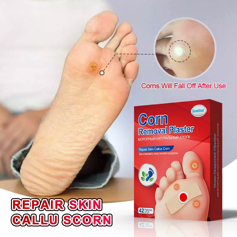 42 Pcs Foot Corn Remover Pads Plantar Wart Thorn Plaster Patch Callus  Removal