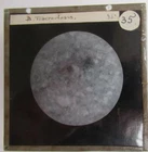 Tuberculosis  Natural History Magic Lantern Slide from microscope image