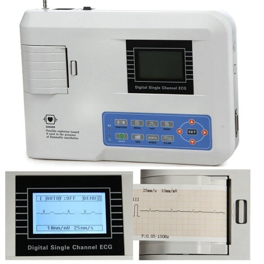 12-Lead EKG ECG Machine - 1-Channel Portable Electrocardiograph with Printout - Image 4 of 4