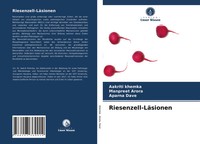 Aakriti Khemka (U. A.) | Riesenzell-LäSionen | Taschenbuch | Deutsch (2021)