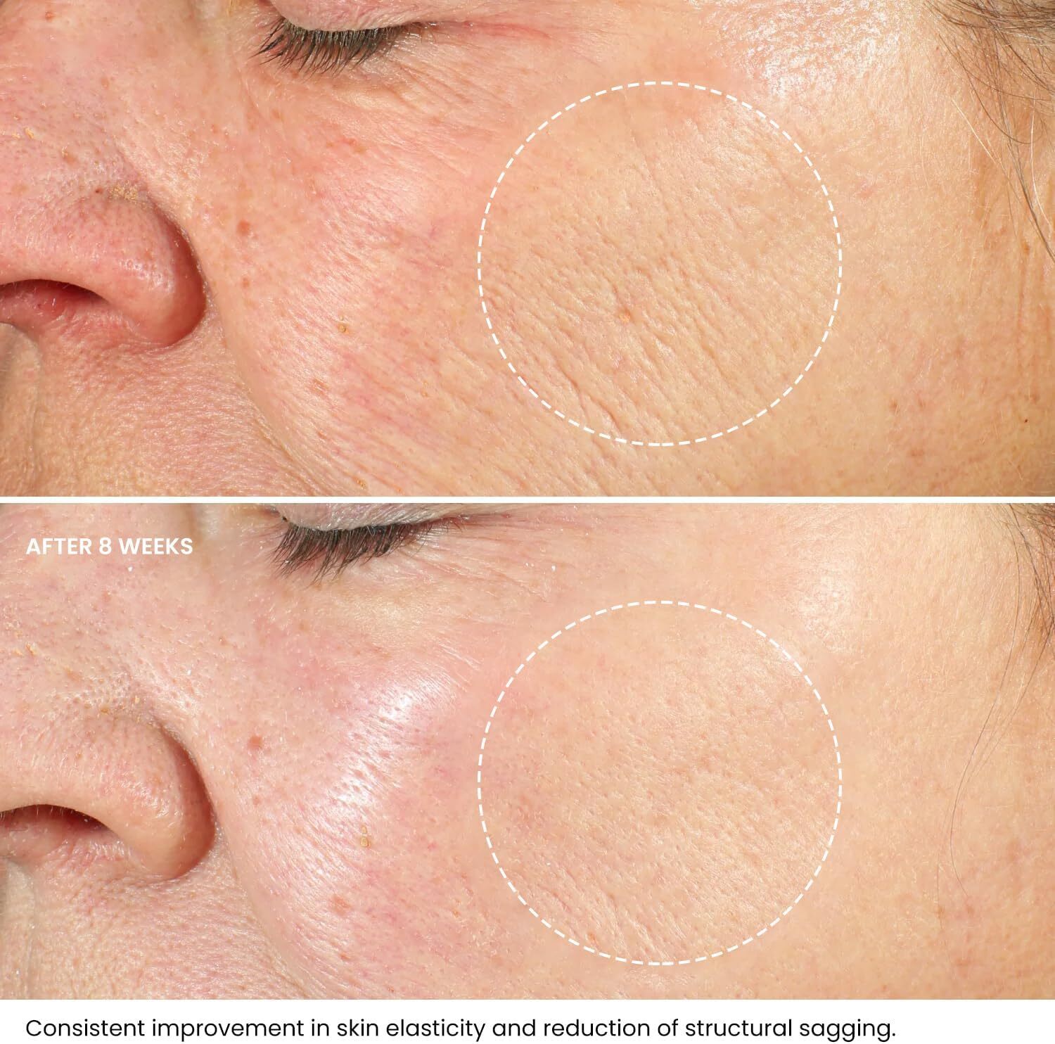 Kleem Retinol Face Cream with 2.5 Retinol, Hyaluronic Acid, Vitamin E