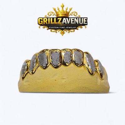 Custom Fit TWO TONES Diamond Dust Grillz (925 Sterling SILVER/Free Mold Kit)