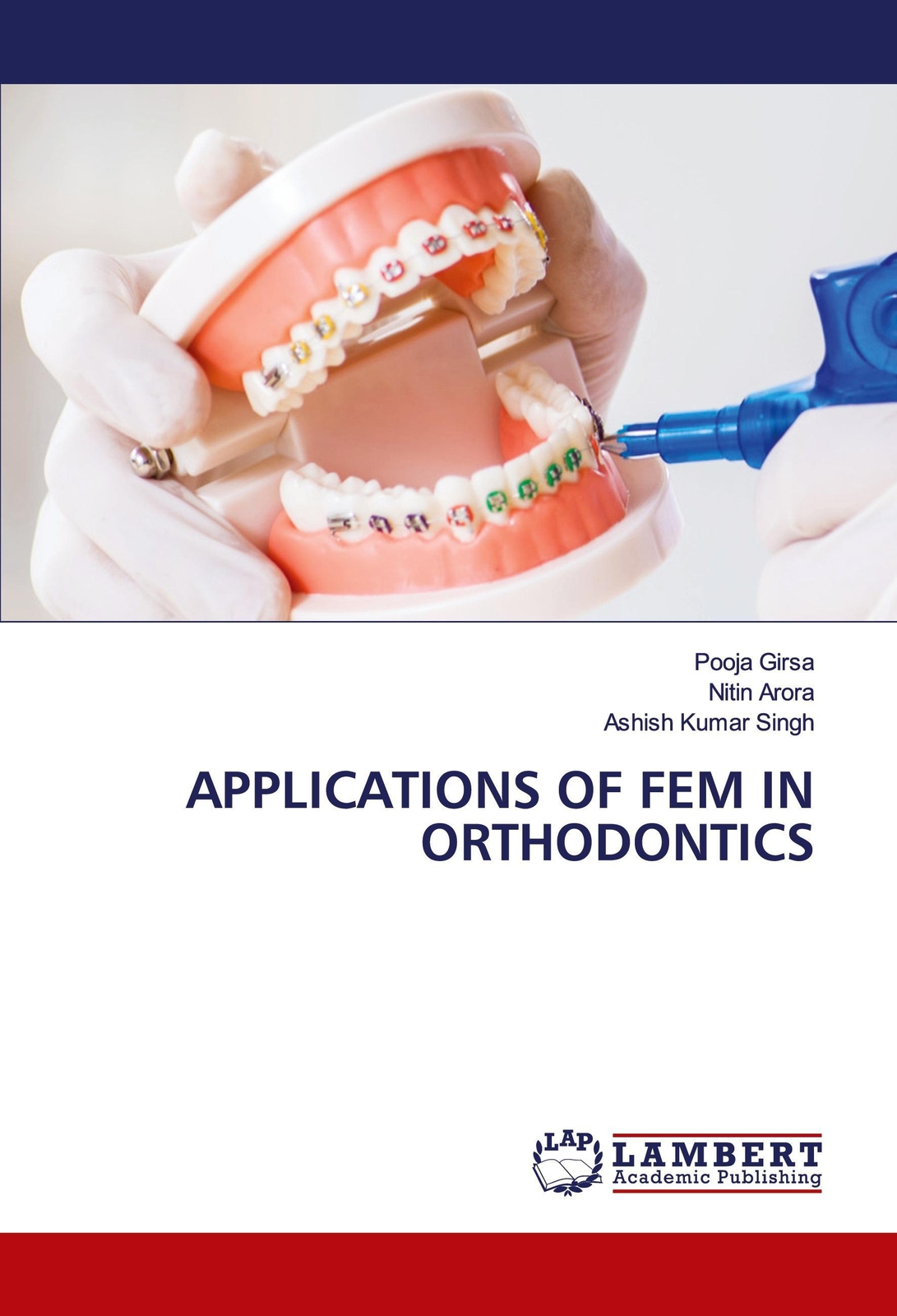 Thumbnail - Applications Of Fem In Orthodontics Pooja Girsa