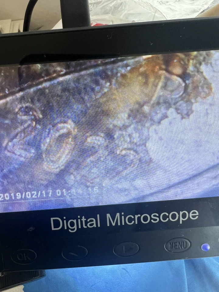 2015 P - 2022 P Roosevelt Dimes, Die Chips And Struck Through Error COLLECTABLES - Image 3 of 4