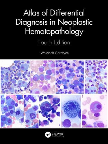Atlas of Differential Diagnosis in Neoplastic Hematopathology by Wojciech ...