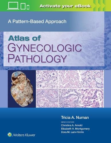 Atlas of Gynecologic Pathology by Tricia A. Numan - 9781975124762