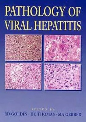Pathologie der Virushepatitis, Dozent R D Goldin, Professor für Medizin 