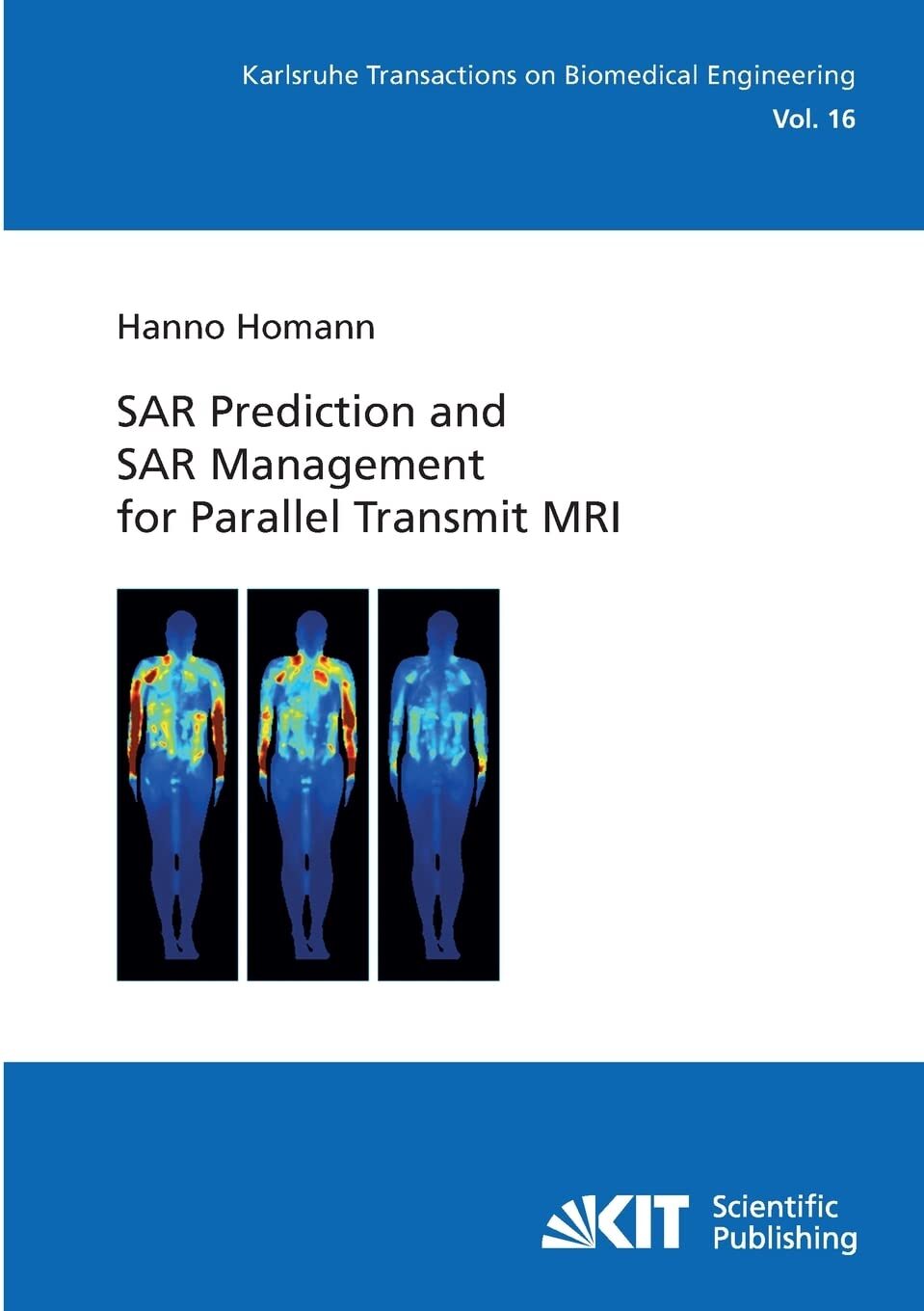 Homann, Hanno Sar Prediction And Sar Management For Parallel Transmit