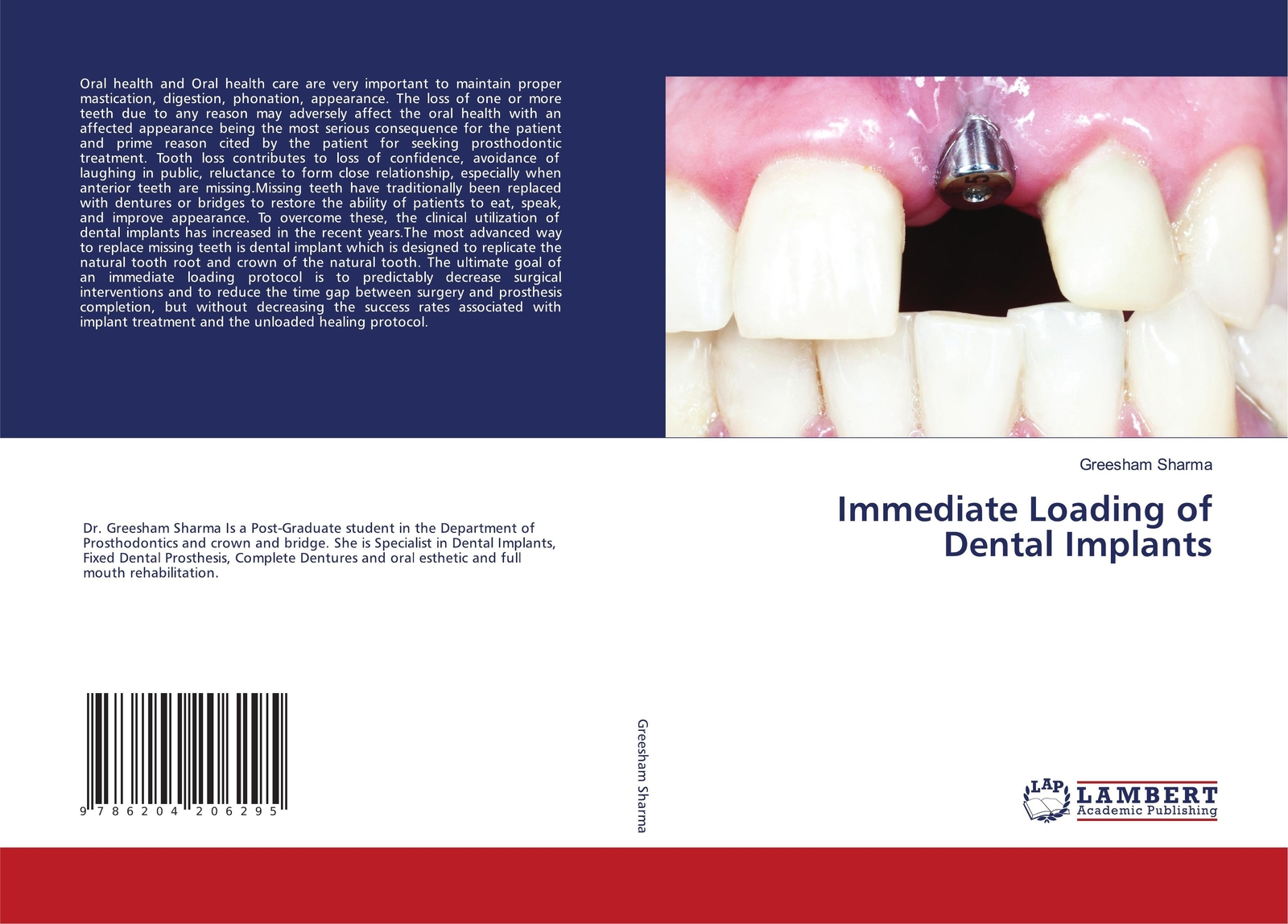Thumbnail - Greesham Sharma | Immediate Loading Of Dental Implants | Taschenbuch |