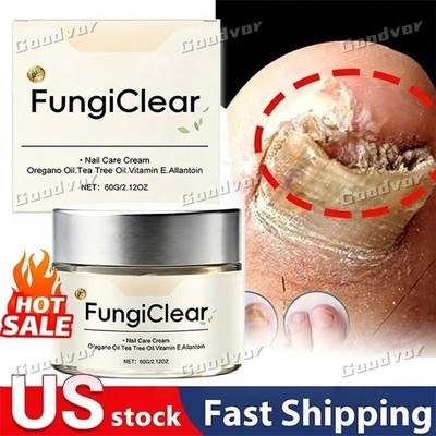 FungiClear Phrena Nail Care Cream With Tea Tree Oil, Oregano Oil, Vitamin E ~US