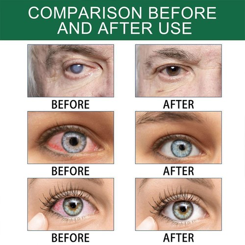 Presbyopia Vision Restore Eye Drops - 10pcs*0.7ml - Sale S6J9 - Picture 10 of 12