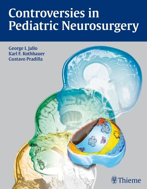 Thumbnail - Controversies In Pediatric Neurosurgery