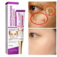 Strong Removal Melasma Whitening Cream Freckle Speckle Sunburn Spots Pigment 30G