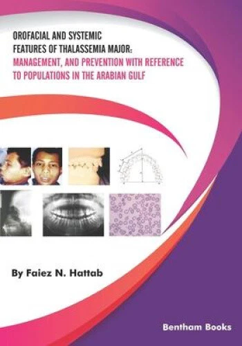 Orofacial and Systemic Features of Thalassemia Major: Management, and - Picture 2 of 2