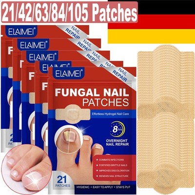 21/42/63/84/105 Stück Nagelpilz Reparaturpflaster,Pilzbehand lung,Nagelreparatur