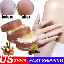 2PCS Crowned Skin Body Butter for Males Women, Crowned Organic Body Butter US