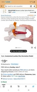 Human Anatomical Lumbar Disc Herniation Model 1.5 Times Life Size Lumbar Model