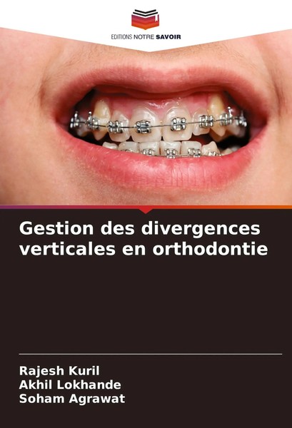 Rajesh Kuril (U. A.) | Gestion Des Divergences Verticales En Orthodontie | Buch-image