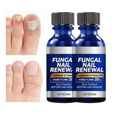 Toenail Fungus Treatment Liquid With Undecylenic Acid 25 Tea Tree Oil 15ml 2