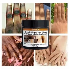 Fast Whitening Dark Knuckles Cream Corrector Moisturizing Strong Brightening