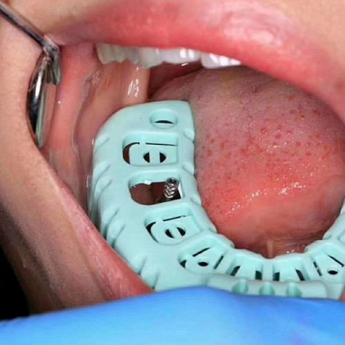 Dental Impression Trays 6Pcs/Set Full Mouth for Teeth Mold Tray Plastic L/M/S - Picture 2 of 10