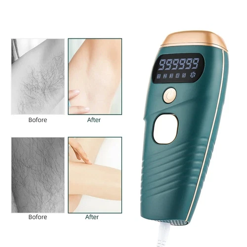 990000 Laser Hair Removal Machine IPL Permanent Painless Epilator Body Facial AU - Picture 8 of 15