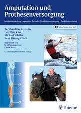 Amputation und Prothesenversorgung Lutz Brüc...