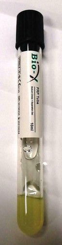 Branded PRP Tubes Sodium Citrate and Separation Gel 10 mL 10 Tubes Mason OEM - Picture 3 of 3