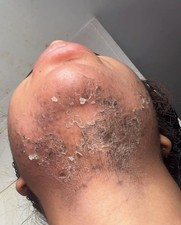 Zena Algenpeeling - Professionelle Pflege zu ...