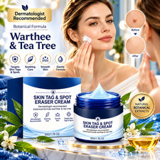 7-Day Skin Tag Spot Eraser Cream, Advanced Imperfection Removal Cream 30ml