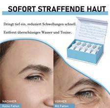 OTVENA Instant Eye Cream 25x1ml Vials ? Gegen...