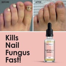 NAIL BRIGHT Serume 30ml KILLS NAIL FUNGUS STOP BACTERIA TOE
